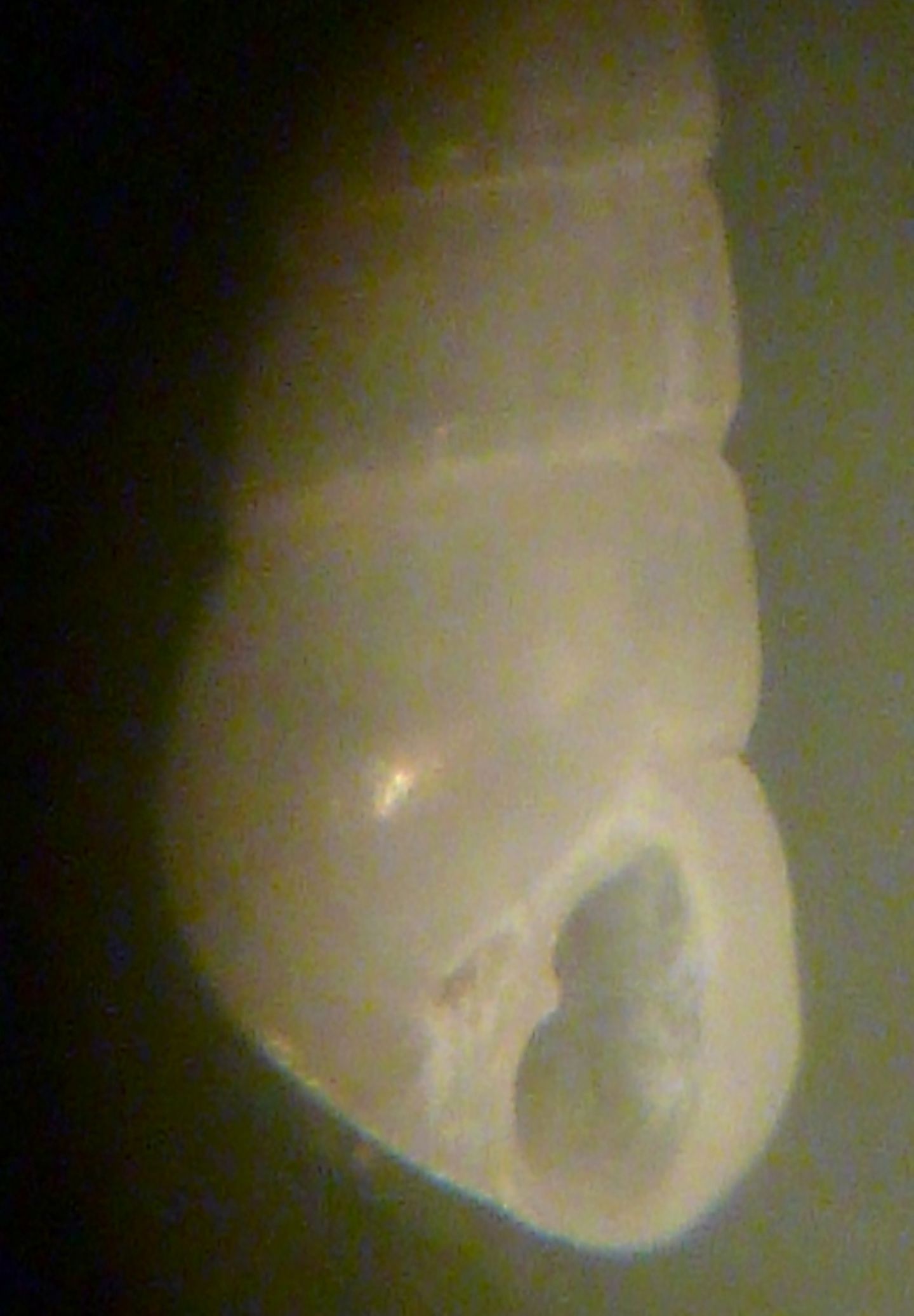 Odostomia turriculata?